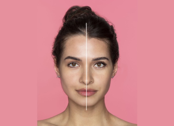 Cirurgia para Assimetria Facial: Quando a Harmonia do Rosto Precisa de Reequilíbrio